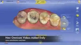 South Tulsa Dentist | Find South Tulsa Dentist | Innovations Dentistry | 918-366-9500