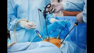 Operative Note in Gynecology ; medical document written immediately after a surgical procedure