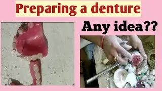 Preparing a denture