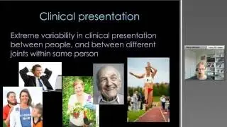 Management of Osteoarthritis