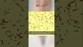 What is SIBO #siboawareness #sibosupport #sibosolutions #guthealth #ibs #ibstreatment #part1