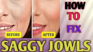 TIGHTEN LOOSE SKIN & FADE WRINKLES #wartiedaboutsaggyskin #howtopreventsaggingofskinafterweightloss