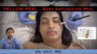 Желтый пилинг (ретинол): лучший антивозрастной пилинг от DrArifMDDermatologist #желтыйпилинг #ухо...