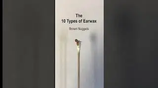 10 Types of Earwax #shorts @fauquierent