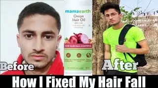 How To Stop Hairfall Naturally | How To Grow Hair Faster Naturally | MamaEarth Onion Oil Review