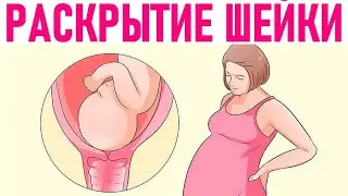 ПОМОГАЕМ ШЕЙКЕ МАТКИ РАСКРЫТЬСЯ  Позы для подготовки и быстрого раскрытия в родах