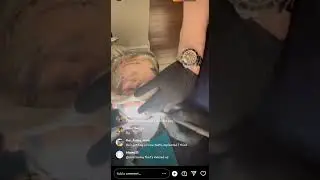 aaron carter getting his teeth fixed at the dentist#aaroncarter #carterverse #lmg