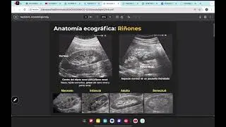 Imagenología repaso de urología