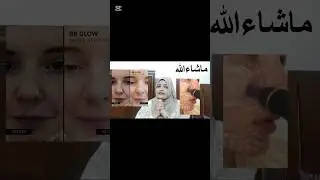 BB Glow Facial Treatment | Bb Glow Permanent Makeup#shorts#bbglow#ytshorts#beauty#viralshorts