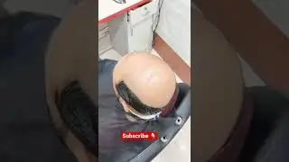 Highlights Hair Patch In Noida | Hair System For Men In Noida | #shorts #viral #youtubeshorts #viral