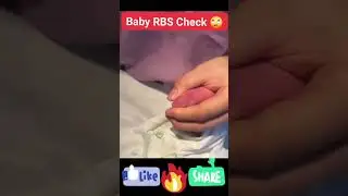 Baby RBS check #mbbs #medical #shorts #nursing&nbsp;#shorts&nbsp;#fypシ゚