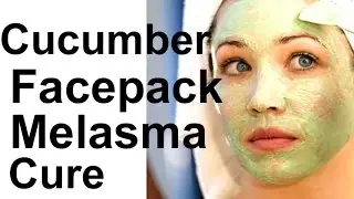 Cucumber Facepack - Natural Treatment For Melasma (Cure) - Home Remedy