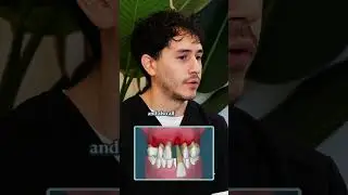 Root Canal vs Extraction + Implant 🦷🔩