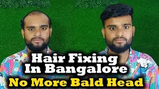 Hair Patch Fixing Service in Bangalore || Natural Look Hair patch in Non Surgical Hair Replacement