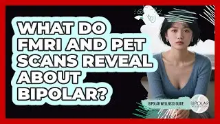 What Do fMRI And PET Scans Reveal About Bipolar? - Bipolar Wellness Guide