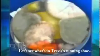 The Doctors TV Show -- what grows inside a shoe