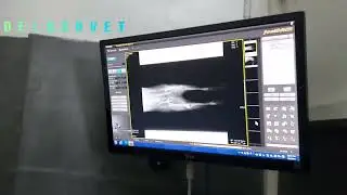 Chronic hind leg lameness in dogs