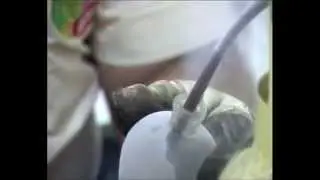 Cold Kills  Refrigerator Pollution