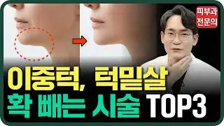 이중턱 없애는 시술 TOP 5ㅣ이중턱살, 턱살 제거방법 (윤곽주사, 브이올렛, 울쎄라, 슈링크, 온다, 인모드)