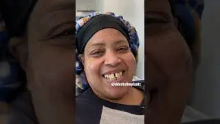 New teeth in 24hrs #florida #virginia #denturegang #newsmile #dentalmakeover #dentalimplants