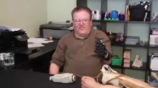 A $50 3D-Printed Prosthesis Compared to a $42,000 Myoelectric Prosthesis (3D Universe)