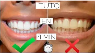 BLANCHIR SES DENTS COMME UNE PRO DE CHEZ SOI !! SOPHIA KASSI