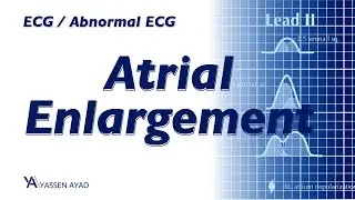 ECG 17 | Atrial enlargement