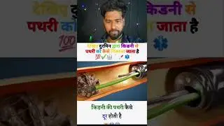 #shortvideo #facts #ekmotahathighumechala #shortvideos #funny #viralvideos #comedy #lifeisbutadream