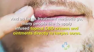 CBD for Herpes - March