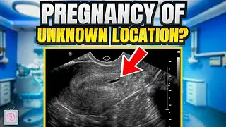 Pregnancy of unknown location - What does it mean for you?