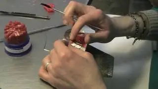 Apparecchio funzionale parte 5 su 11