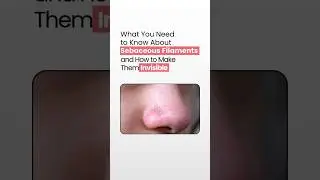 Bye Bye Nose Gunk 👃✨ Best Products for Sebaceous Filaments!