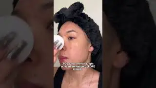 Don't Struggle with Hormonal Acne & Cystic Bumps