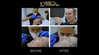 10 Years Younger Season 3 | Dr Tapan Patel, PHI Clinic London