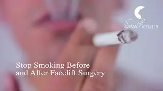 Why Smokers Should Stop Smoking Before and After Facelift Surgery - Houston Smith Center