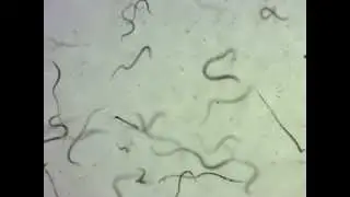 Vinegar Eels