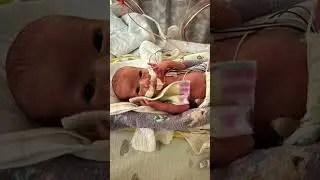 My Grandaughter born at 28 weeks in Florida
