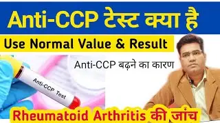 What is Anti-CCP Test Use Indications Normal Value  | Anti Cyclic Citrullinated Peptide test