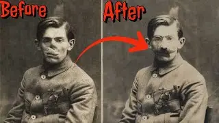 The father of plastic surgery..