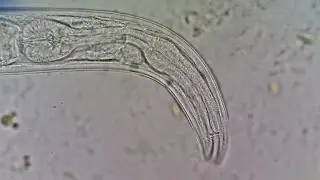 Soil nematode - free living nematode (Rhabditida)