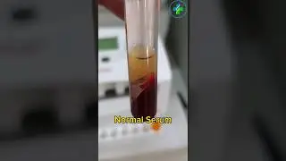 Normal Serum | Serum | Serology #medicallaboratory #bloodtest #medicallab