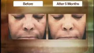 Sun screen can help prevent skin damage