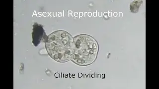 Asexual Reproduction Ciliate Dividing