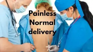 Painless normal delivery l pros & cons #pregnancy #painlessdelivery ##deliverytips #epidural