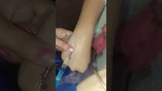💉🩸 #ivinjection #injection #drdivyatiwari #ytshorts #yt #trending #shortsviral #shorts #iv #cannula