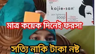 Kojie  San Soap  Review।।। কোজি সান সাবান  রিভিউ