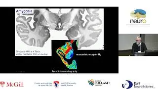 BigBrain Workshop 2017