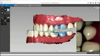 Trophy Imaging Software University | Registro de Oclusión Trophy 3DI PRO