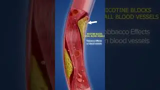 🚫 Cool Lip Affects Your Married Life | Health Awareness Shorts