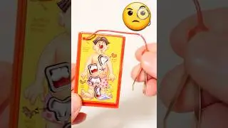 I Played The Worlds Smallest Operation!
